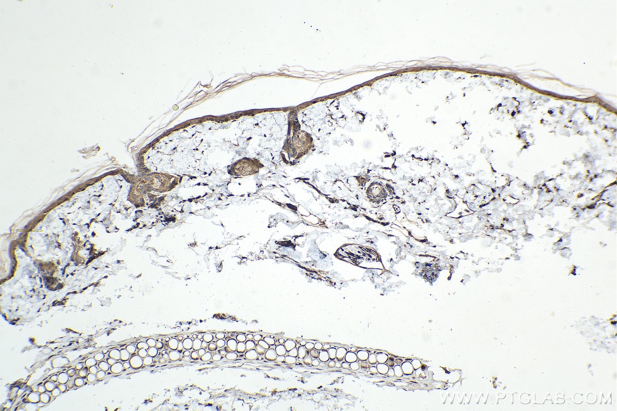 Immunohistochemical analysis of paraffin-embedded rat skin tissue slide using KHC1585 (DDIT3 IHC Kit).