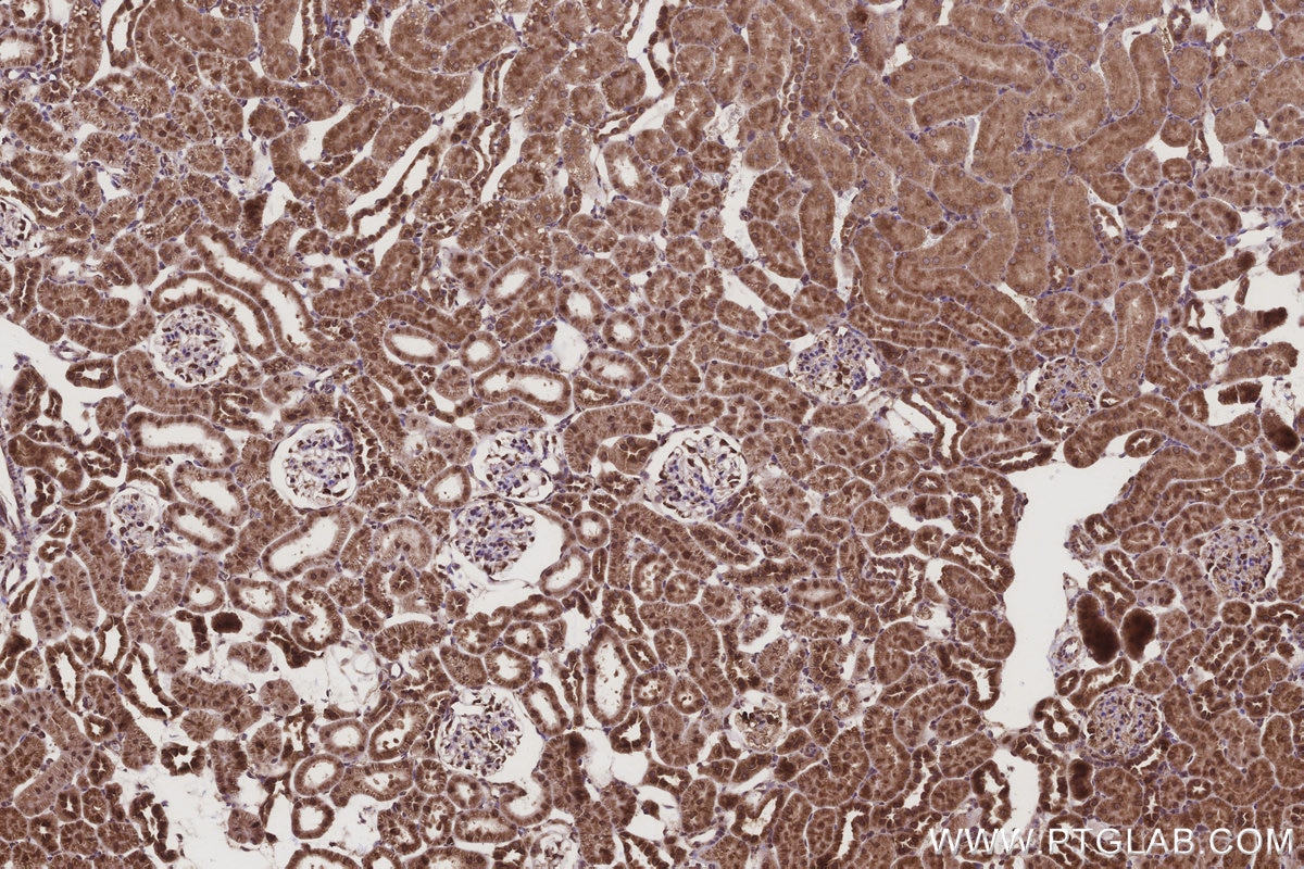 Immunohistochemical analysis of paraffin-embedded rat kidney tissue slide using KHC3208 (DDOST IHC Kit). Immunohistochemical analysis of paraffin-embedded rat kidney tissue slide using KHC3208 (DDOST IHC Kit).