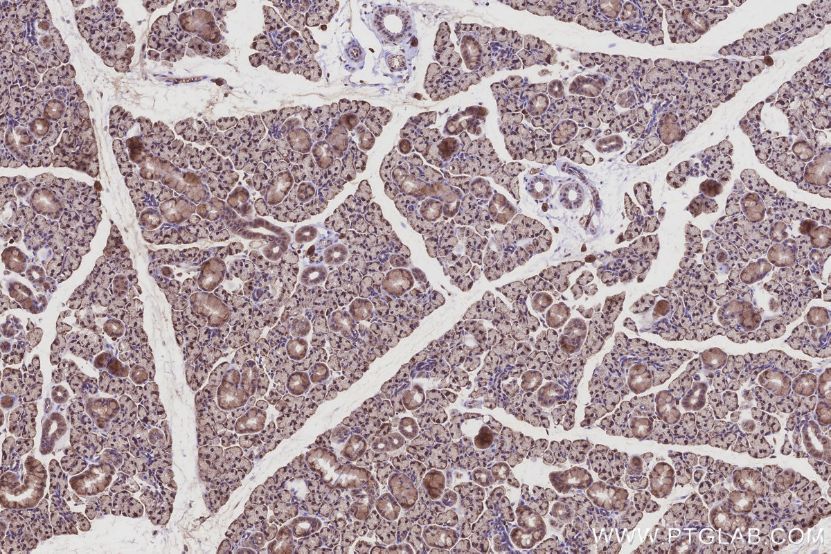 Immunohistochemical analysis of paraffin-embedded rat salivary gland tissue slide using KHC3208 (DDOST IHC Kit). Immunohistochemical analysis of paraffin-embedded rat salivary gland tissue slide using KHC3208 (DDOST IHC Kit).