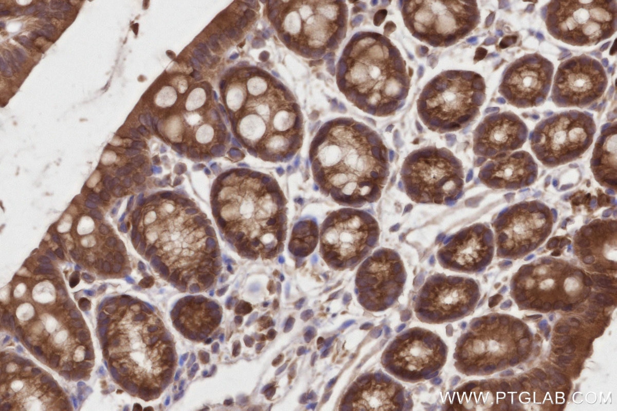 Immunohistochemical analysis of paraffin-embedded mouse colon tissue slide using KHC2799 (DDRGK1 IHC Kit).