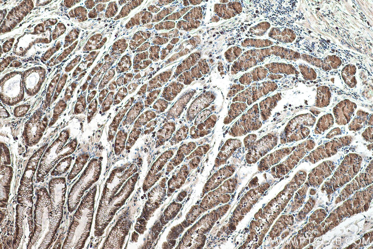 Immunohistochemical analysis of paraffin-embedded human stomach cancer(NAT) tissue slide using KHC0527 (DDT IHC Kit).