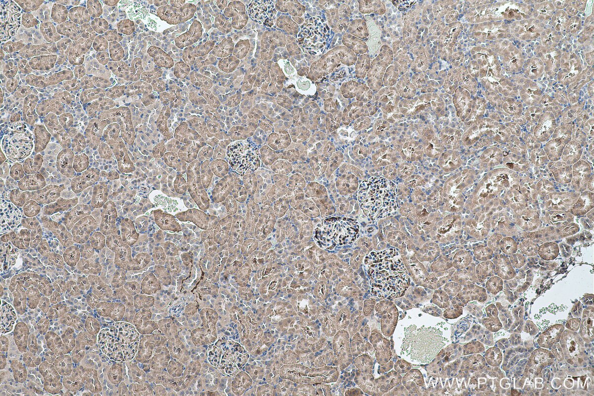 Immunohistochemical analysis of paraffin-embedded rat kidney tissue slide using KHC0527 (DDT IHC Kit).