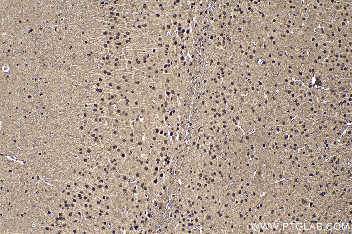 Immunohistochemical analysis of paraffin-embedded mouse brain tissue slide using KHC1847 (DDX1 IHC Kit).