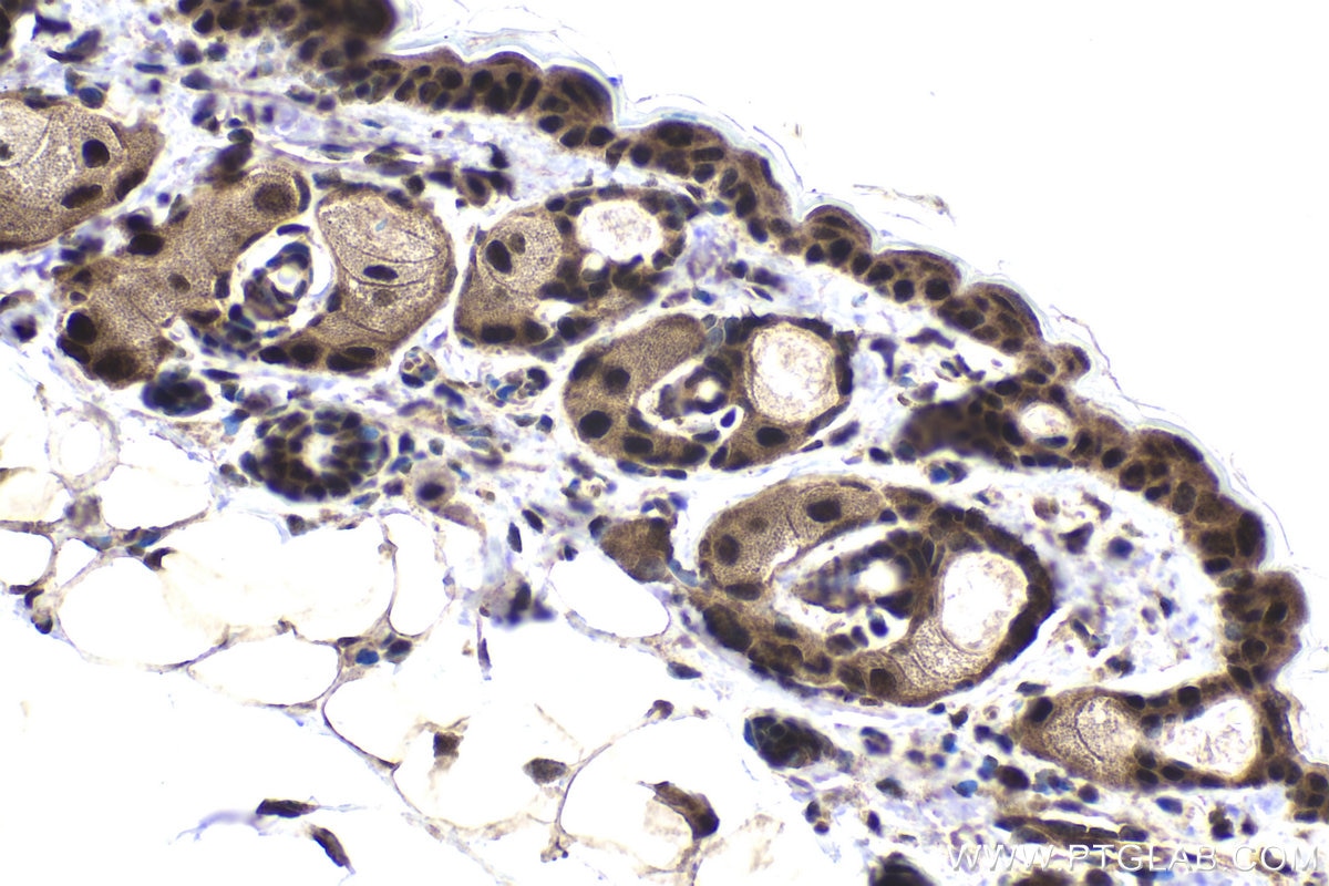Immunohistochemical analysis of paraffin-embedded mouse skin tissue slide using KHC1847 (DDX1 IHC Kit).