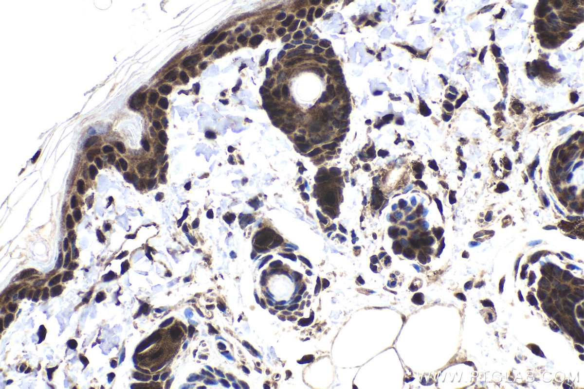 Immunohistochemical analysis of paraffin-embedded rat skin tissue slide using KHC1847 (DDX1 IHC Kit).