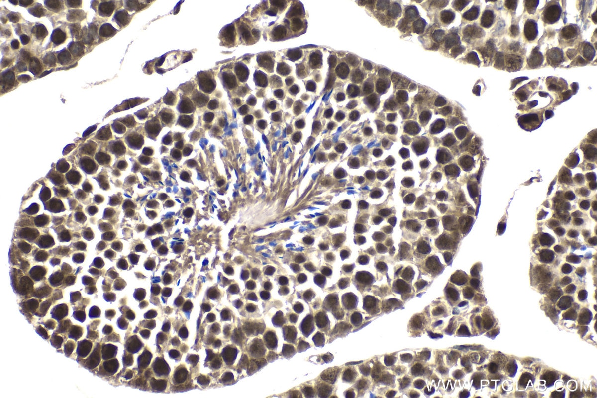 Immunohistochemical analysis of paraffin-embedded mouse testis tissue slide using KHC1859 (DDX17 IHC Kit).