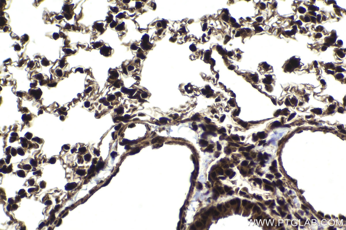 Immunohistochemical analysis of paraffin-embedded mouse lung tissue slide using KHC1859 (DDX17 IHC Kit).