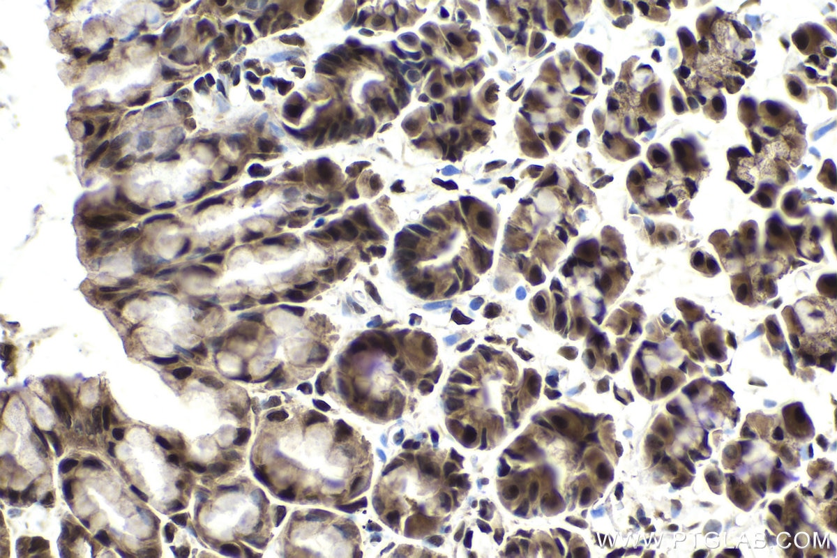 Immunohistochemical analysis of paraffin-embedded rat stomach tissue slide using KHC1859 (DDX17 IHC Kit).