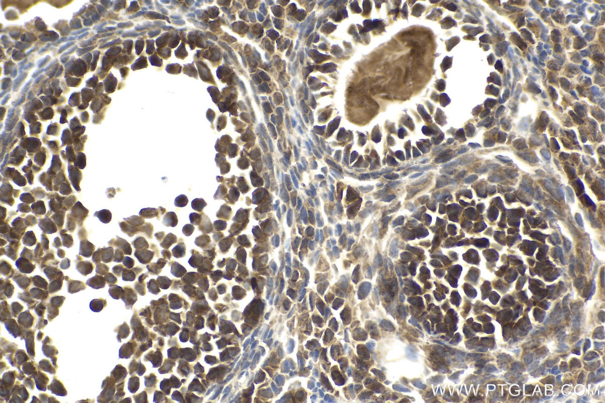 Immunohistochemical analysis of paraffin-embedded mouse ovary tissue slide using KHC1983 (DDX20 IHC Kit).