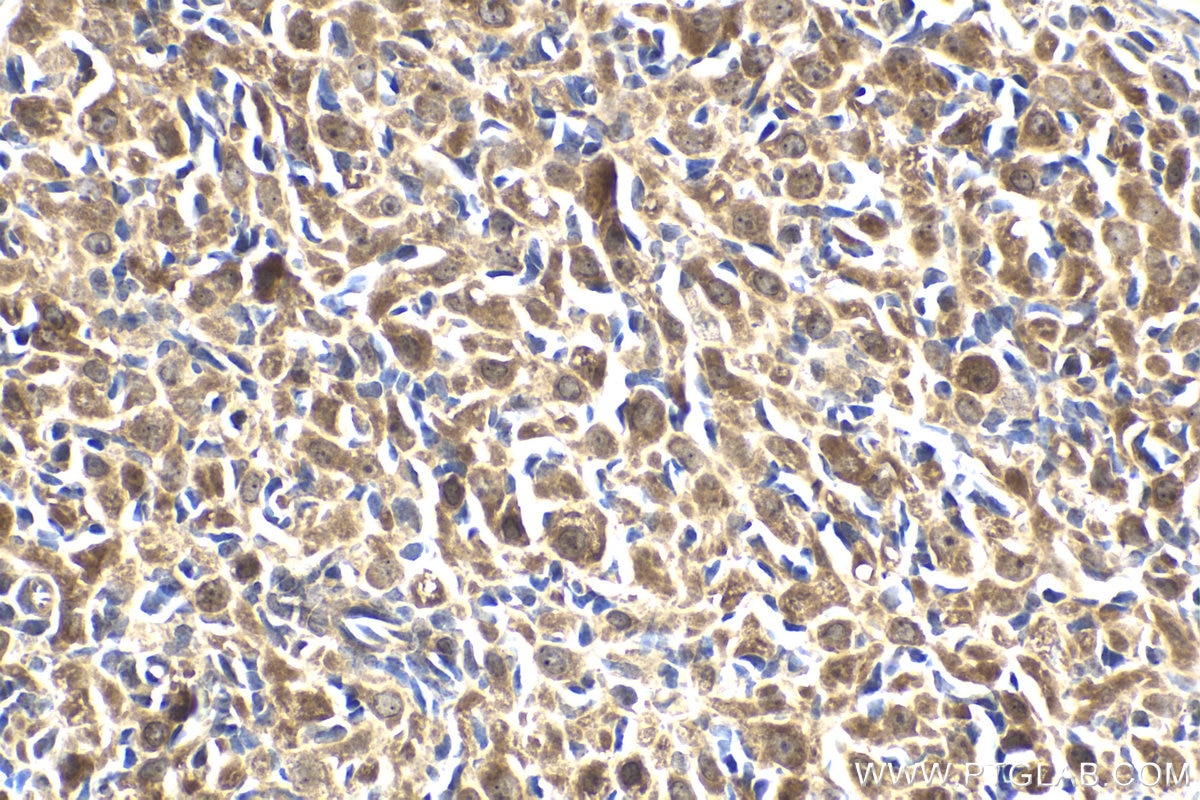 Immunohistochemical analysis of paraffin-embedded rat ovary tissue slide using KHC1983 (DDX20 IHC Kit).
