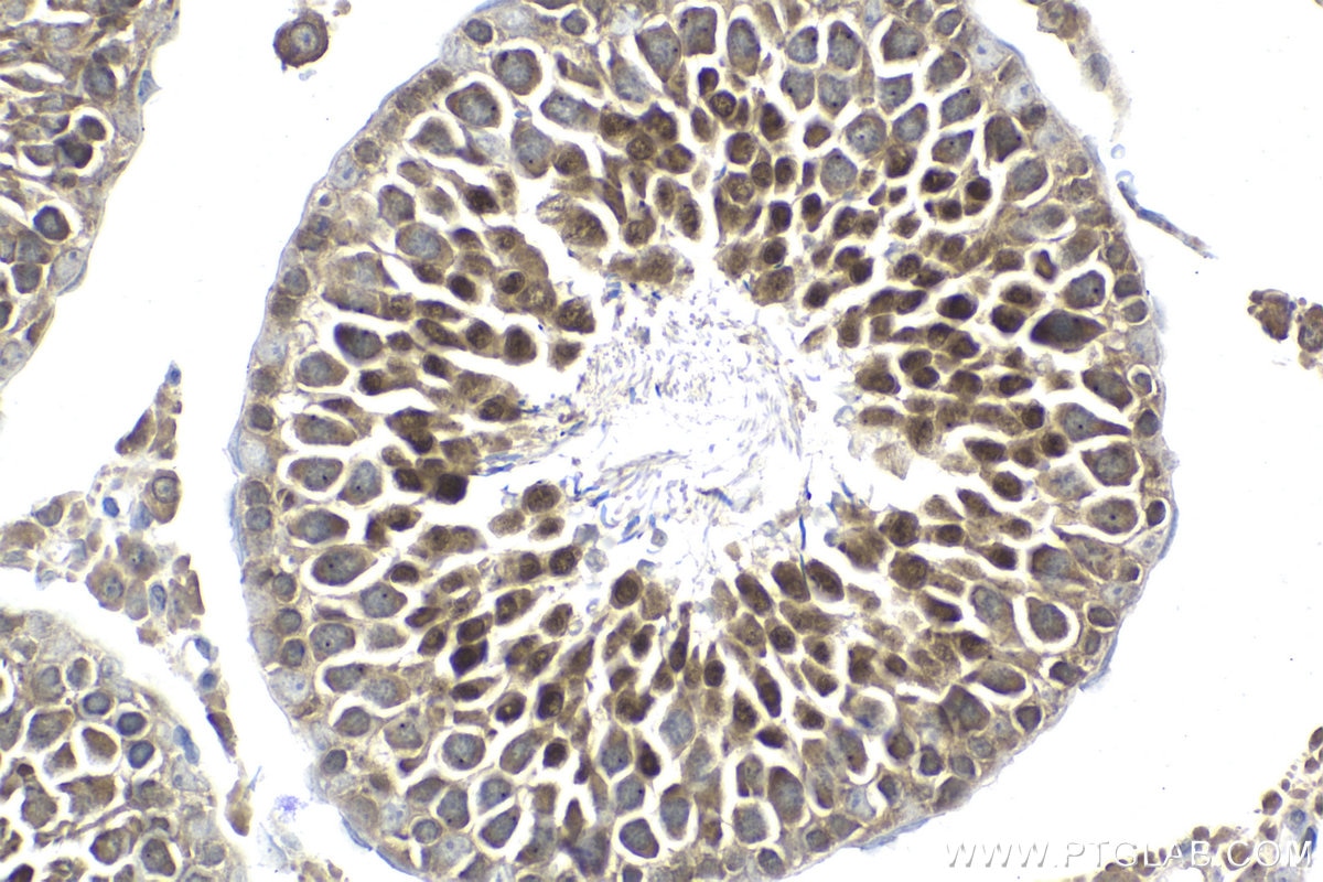 Immunohistochemical analysis of paraffin-embedded rat testis tissue slide using KHC1983 (DDX20 IHC Kit).