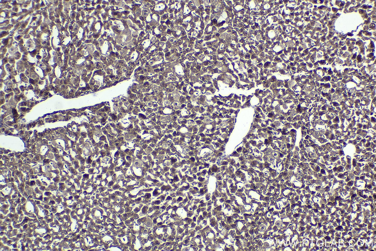 Immunohistochemical analysis of paraffin-embedded mouse liver tissue slide using KHC1424 (DDX3 IHC Kit).