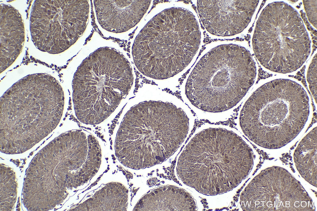 Immunohistochemical analysis of paraffin-embedded rat testis tissue slide using KHC1424 (DDX3 IHC Kit).
