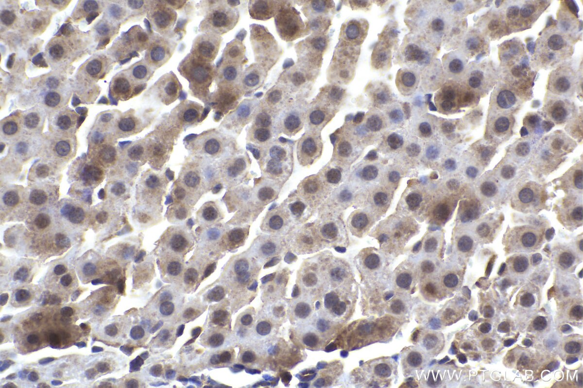 Immunohistochemical analysis of paraffin-embedded rat liver tissue slide using KHC1424 (DDX3 IHC Kit).