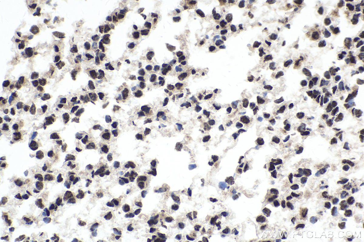 Immunohistochemical analysis of paraffin-embedded mouse lung tissue slide using KHC1720 (DDX39B IHC Kit).