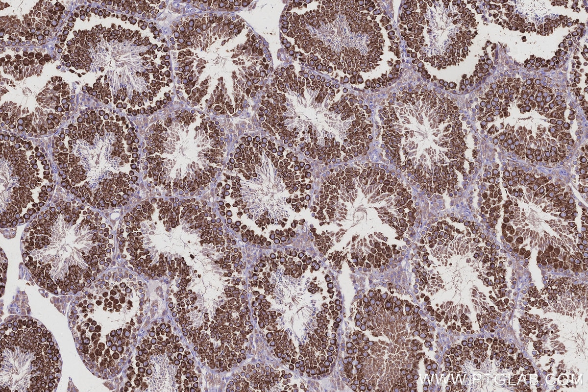 Immunohistochemical analysis of paraffin-embedded mouse testis tissue slide using KHC2943 (DDX4/VASA IHC Kit).