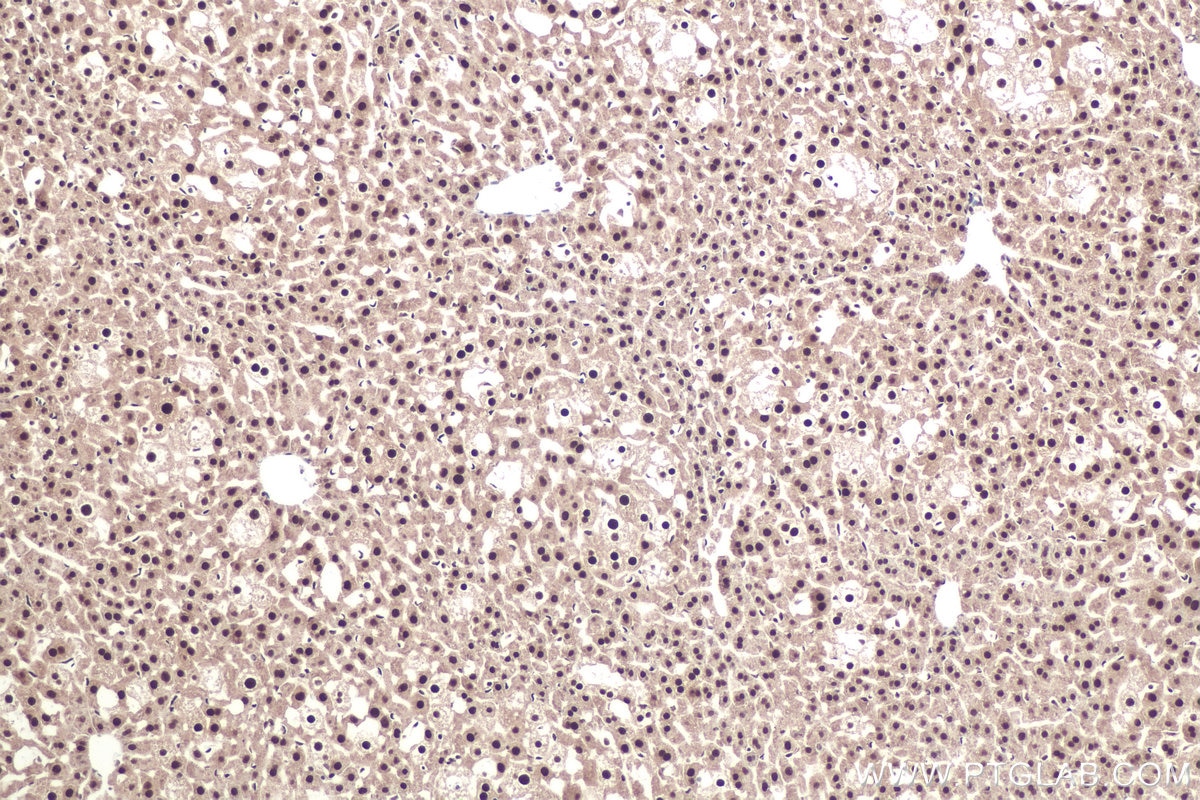 Immunohistochemical analysis of paraffin-embedded mouse liver tissue slide using KHC0913 (DDX5 IHC Kit).