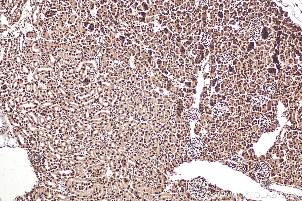 Immunohistochemical analysis of paraffin-embedded mouse kidney tissue slide using KHC0913 (DDX5 IHC Kit).