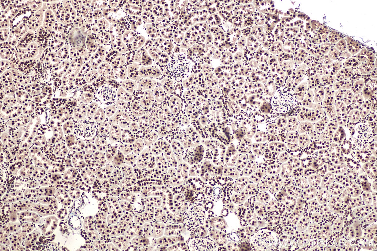Immunohistochemical analysis of paraffin-embedded rat kidney tissue slide using KHC0913 (DDX5 IHC Kit).