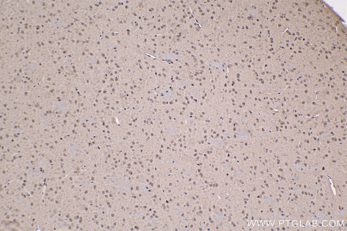 Immunohistochemical analysis of paraffin-embedded mouse brain tissue slide using KHC1473 (DEAF1 IHC Kit).