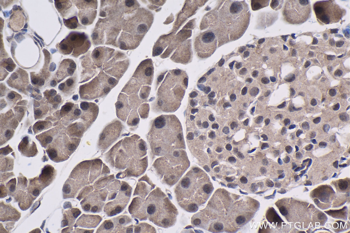 Immunohistochemical analysis of paraffin-embedded mouse pancreas tissue slide using KHC1473 (DEAF1 IHC Kit).