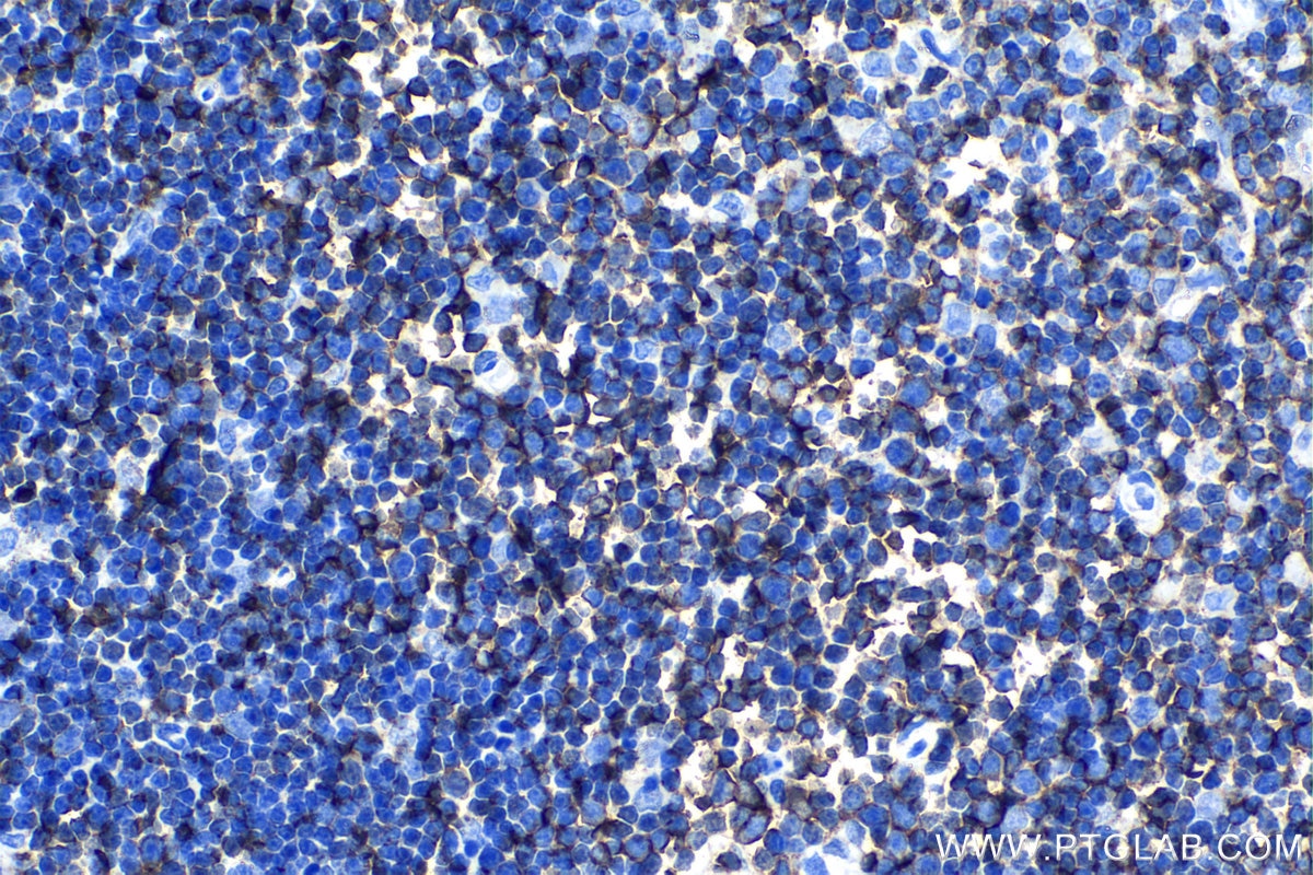 Immunohistochemical analysis of paraffin-embedded rat thymus tissue slide using KHC1195 (DEF6 IHC Kit).