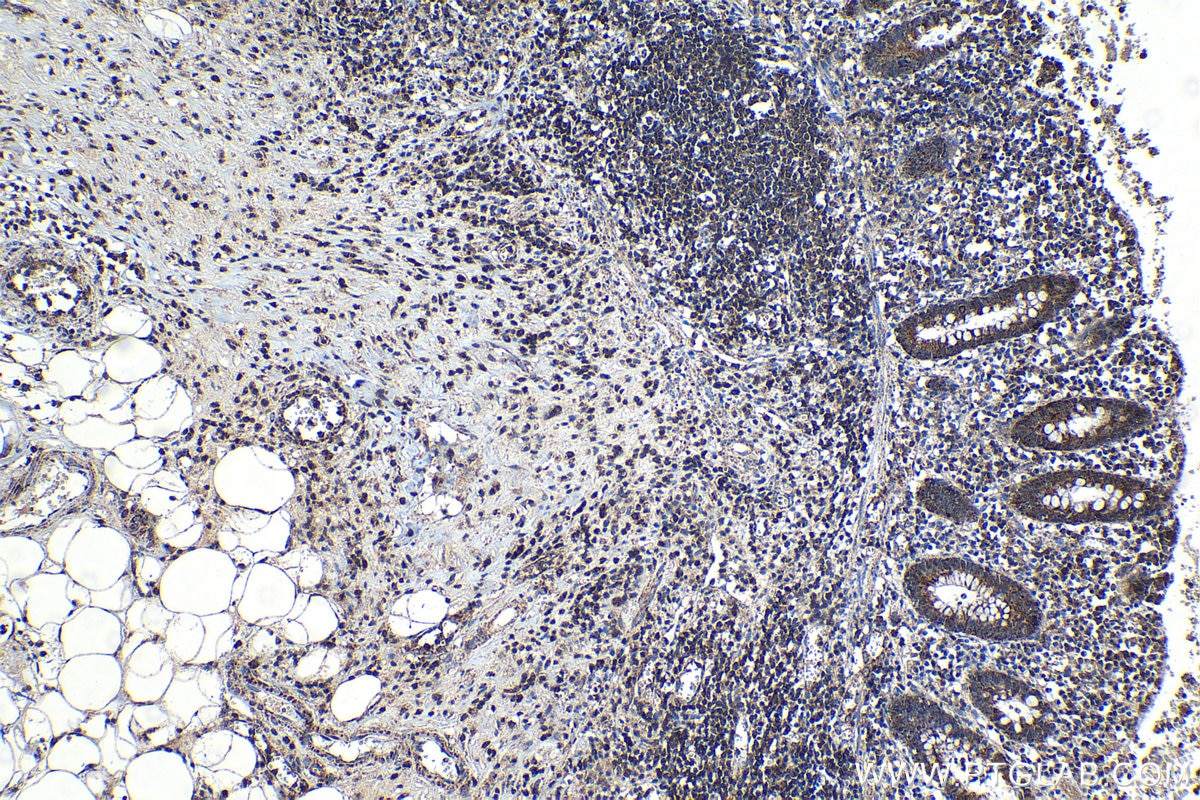 Immunohistochemical analysis of paraffin-embedded human appendicitis tissue slide using KHC1195 (DEF6 IHC Kit).