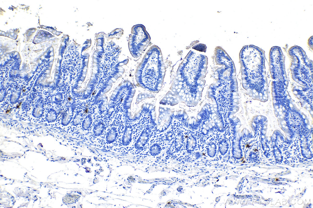 Immunohistochemical analysis of paraffin-embedded human small intestine tissue slide using KHC1167 (DEFA1 IHC Kit).