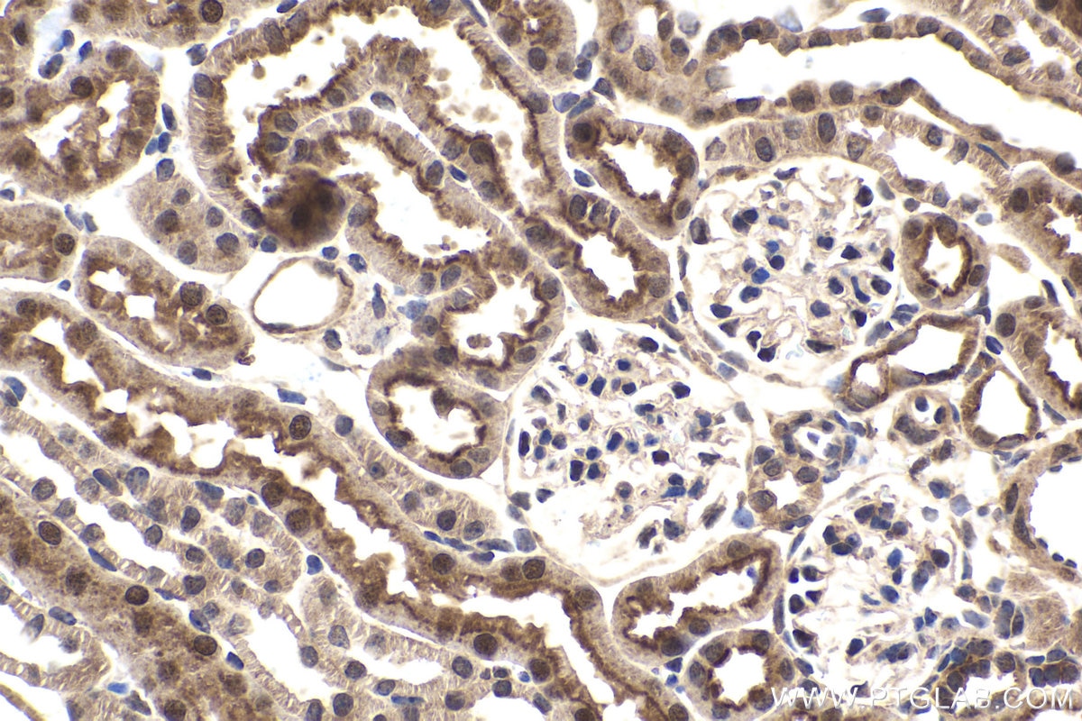 Immunohistochemical analysis of paraffin-embedded mouse kidney tissue slide using KHC1623 (DGKQ IHC Kit).