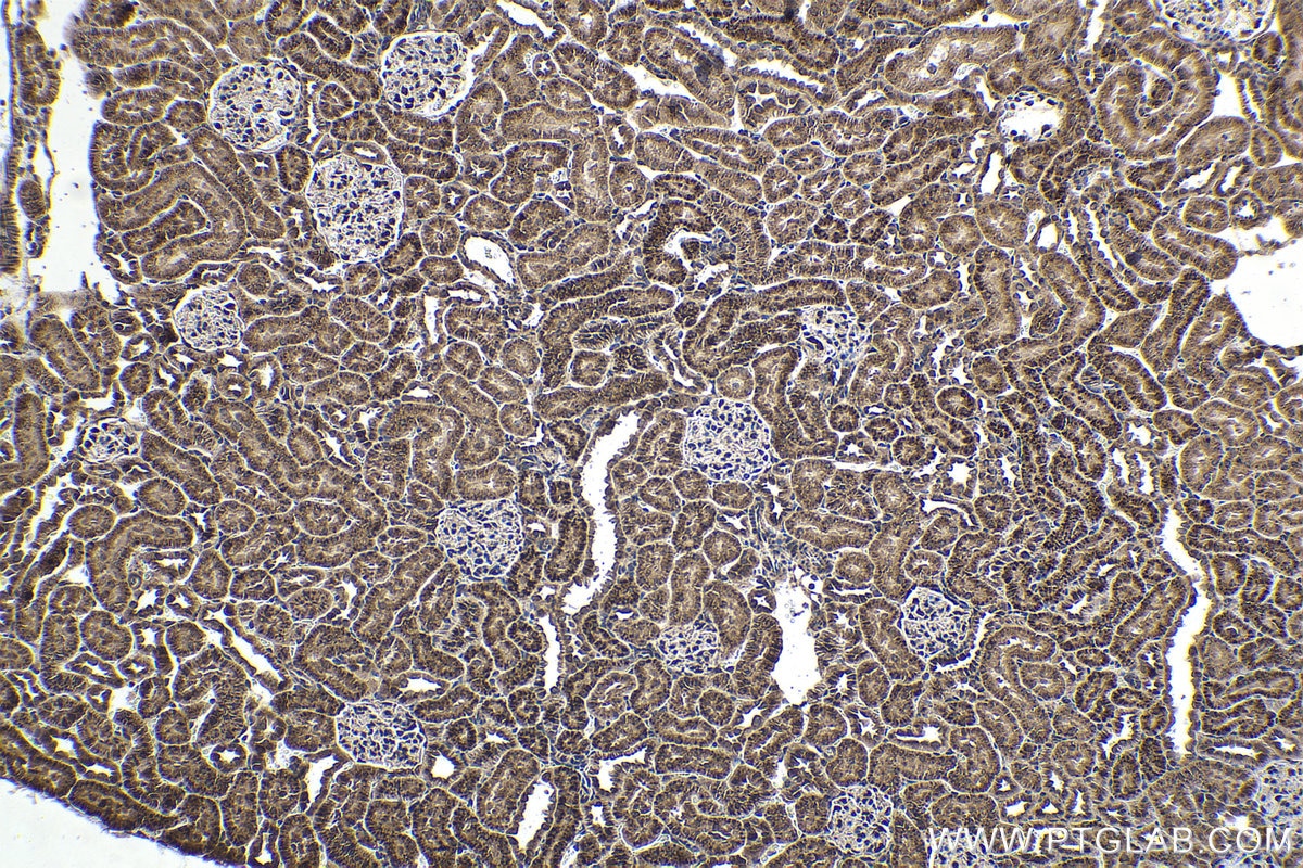 Immunohistochemical analysis of paraffin-embedded rat kidney tissue slide using KHC1623 (DGKQ IHC Kit).