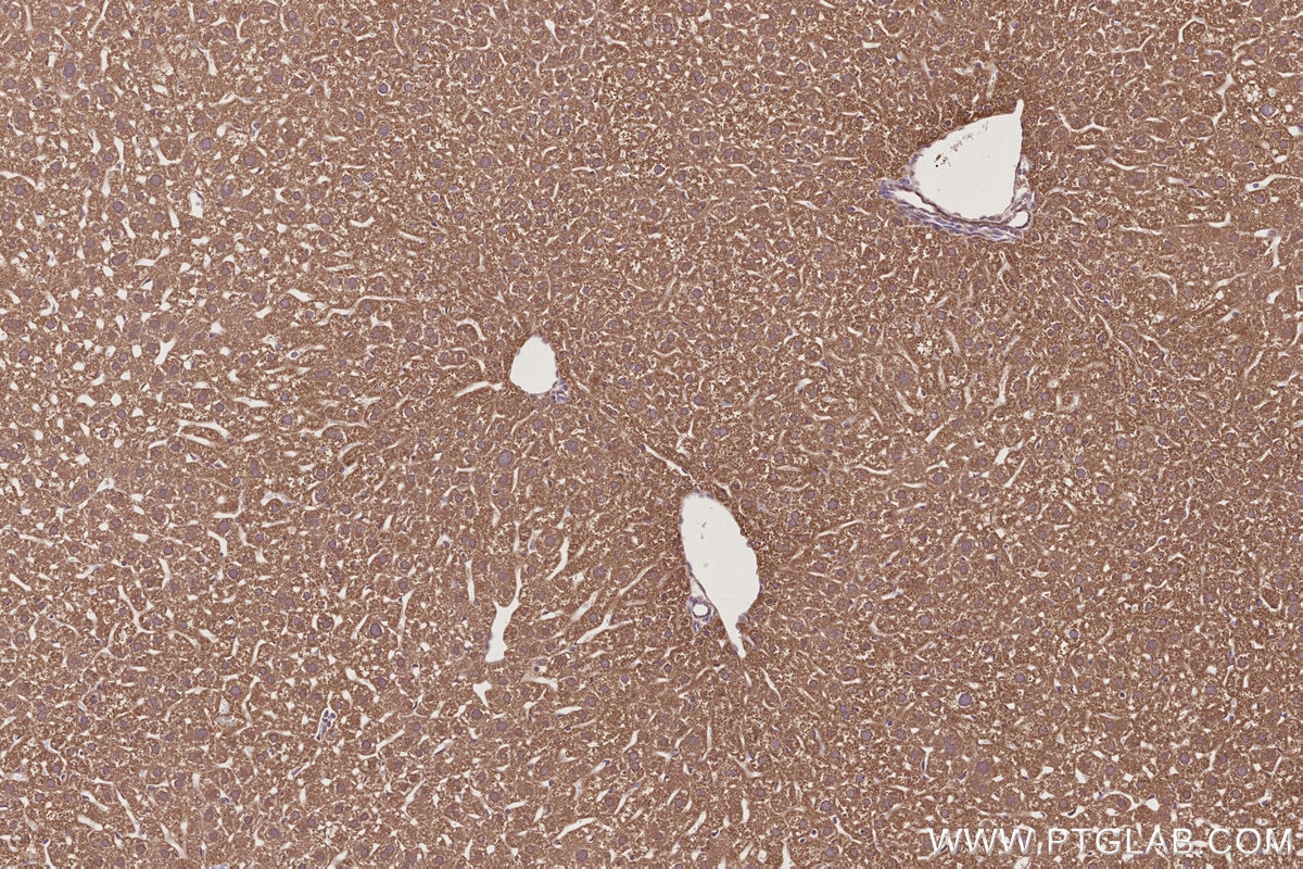Immunohistochemical analysis of paraffin-embedded mouse liver tissue slide using KHC2800 (DHTKD1 IHC Kit).
