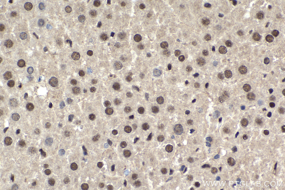 Immunohistochemical analysis of paraffin-embedded mouse liver tissue slide using KHC1848 (DHX38 IHC Kit).