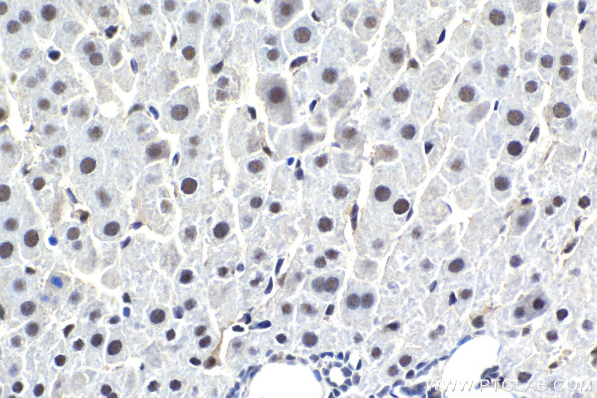Immunohistochemical analysis of paraffin-embedded rat liver tissue slide using KHC1848 (DHX38 IHC Kit).