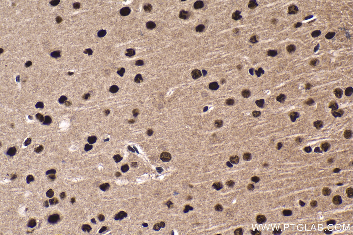 Immunohistochemical analysis of paraffin-embedded mouse brain tissue slide using KHC1685 (DHX9 IHC Kit).