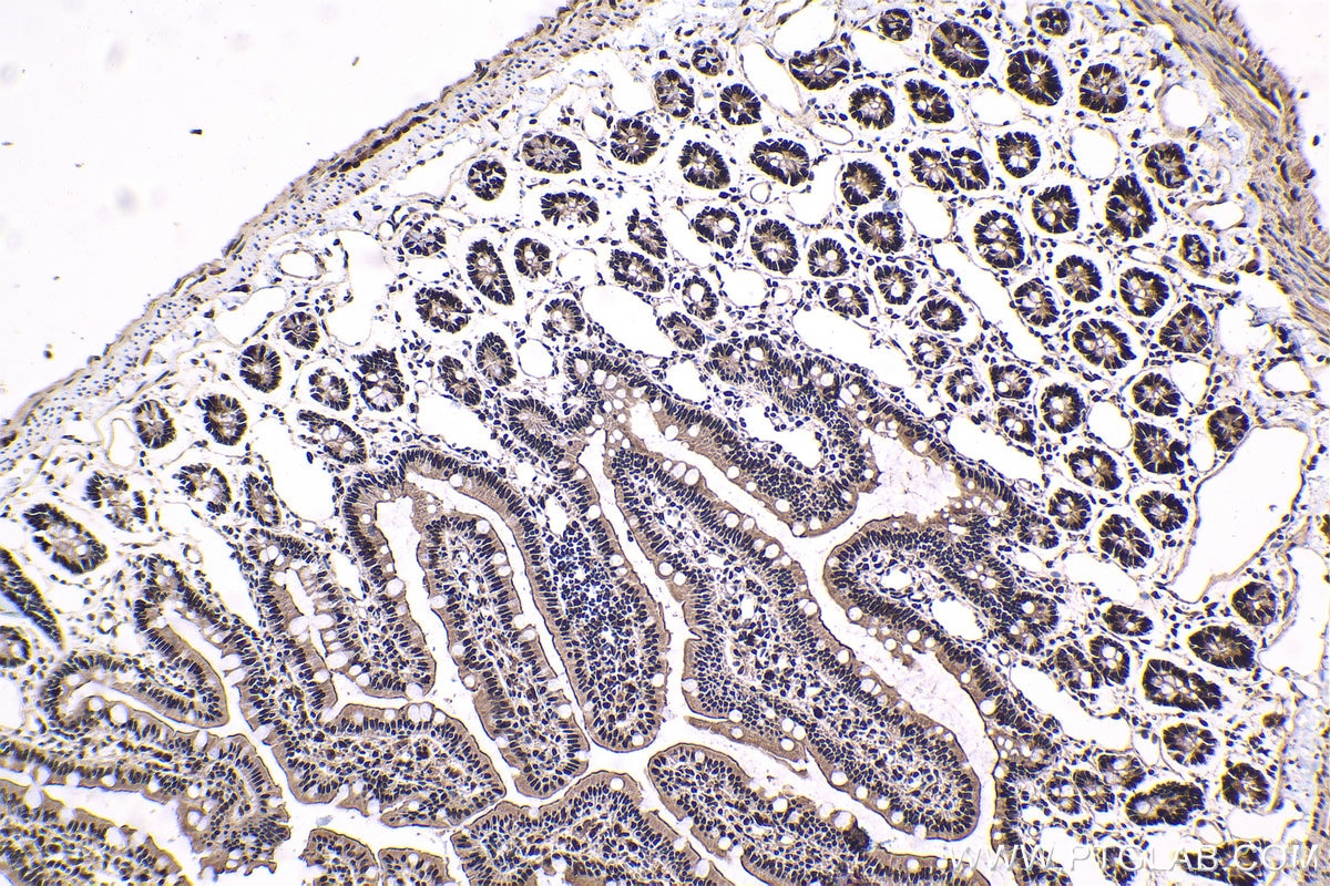 Immunohistochemical analysis of paraffin-embedded rat small intestine tissue slide using KHC1685 (DHX9 IHC Kit).
