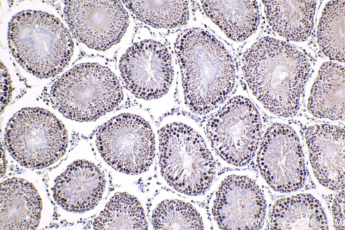 Immunohistochemical analysis of paraffin-embedded rat testis tissue slide using KHC1685 (DHX9 IHC Kit).