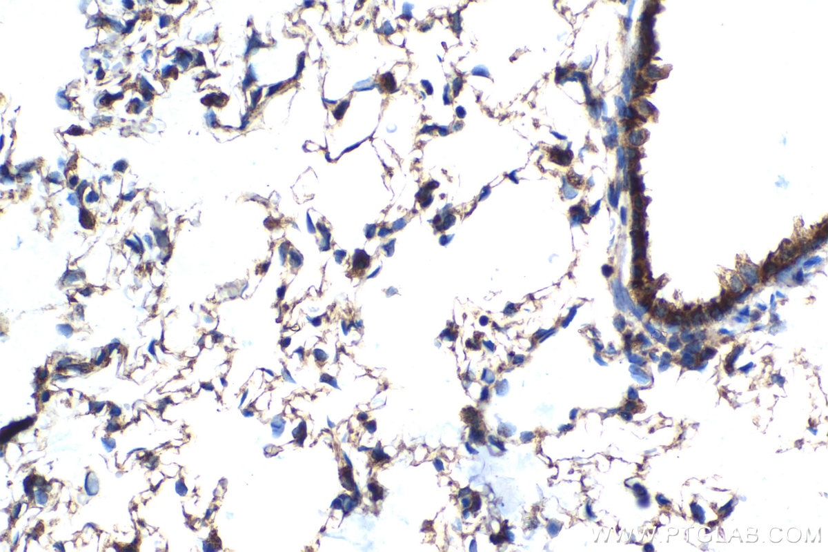 Immunohistochemical analysis of paraffin-embedded rat lung tissue slide using KHC2100 (DIAPH1 IHC Kit).