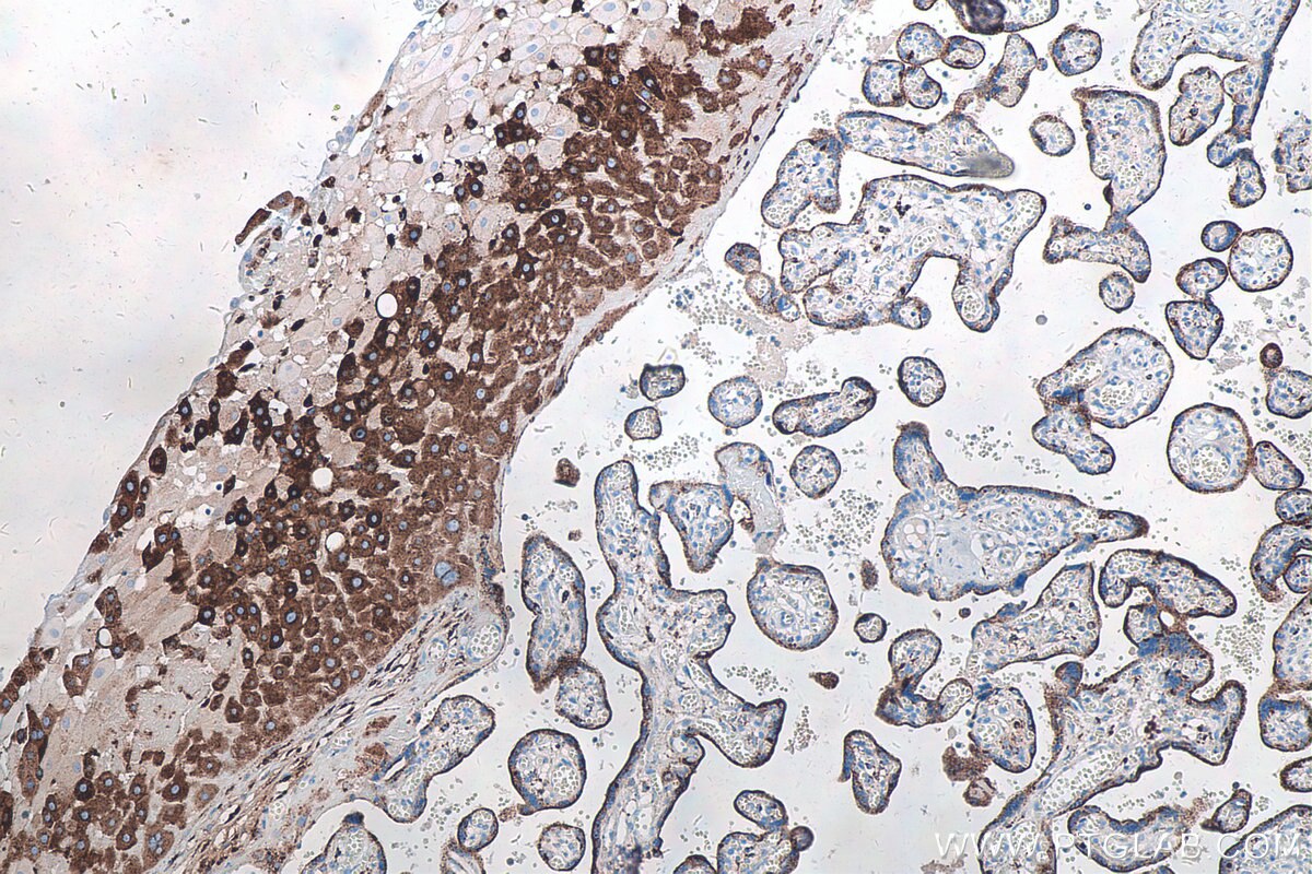 Immunohistochemical analysis of paraffin-embedded human placenta tissue slide using KHC0252 (DIO2 IHC Kit).