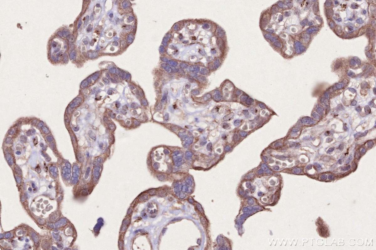 Immunohistochemical analysis of paraffin-embedded human placenta tissue slide using KHC2689 (DIPK2A/C3orf58 IHC Kit).