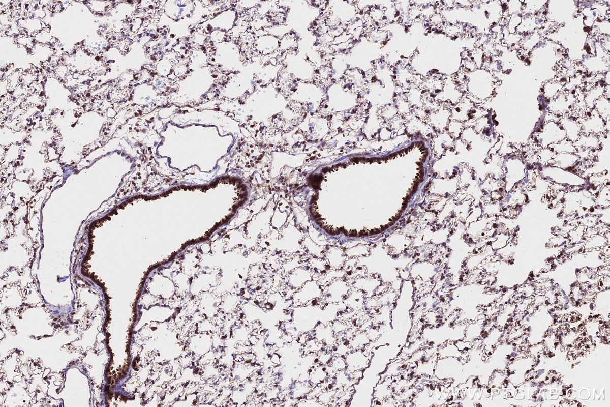 Immunohistochemical analysis of paraffin-embedded rat lung tissue slide using KHC2659 (DIS3L2 IHC Kit).