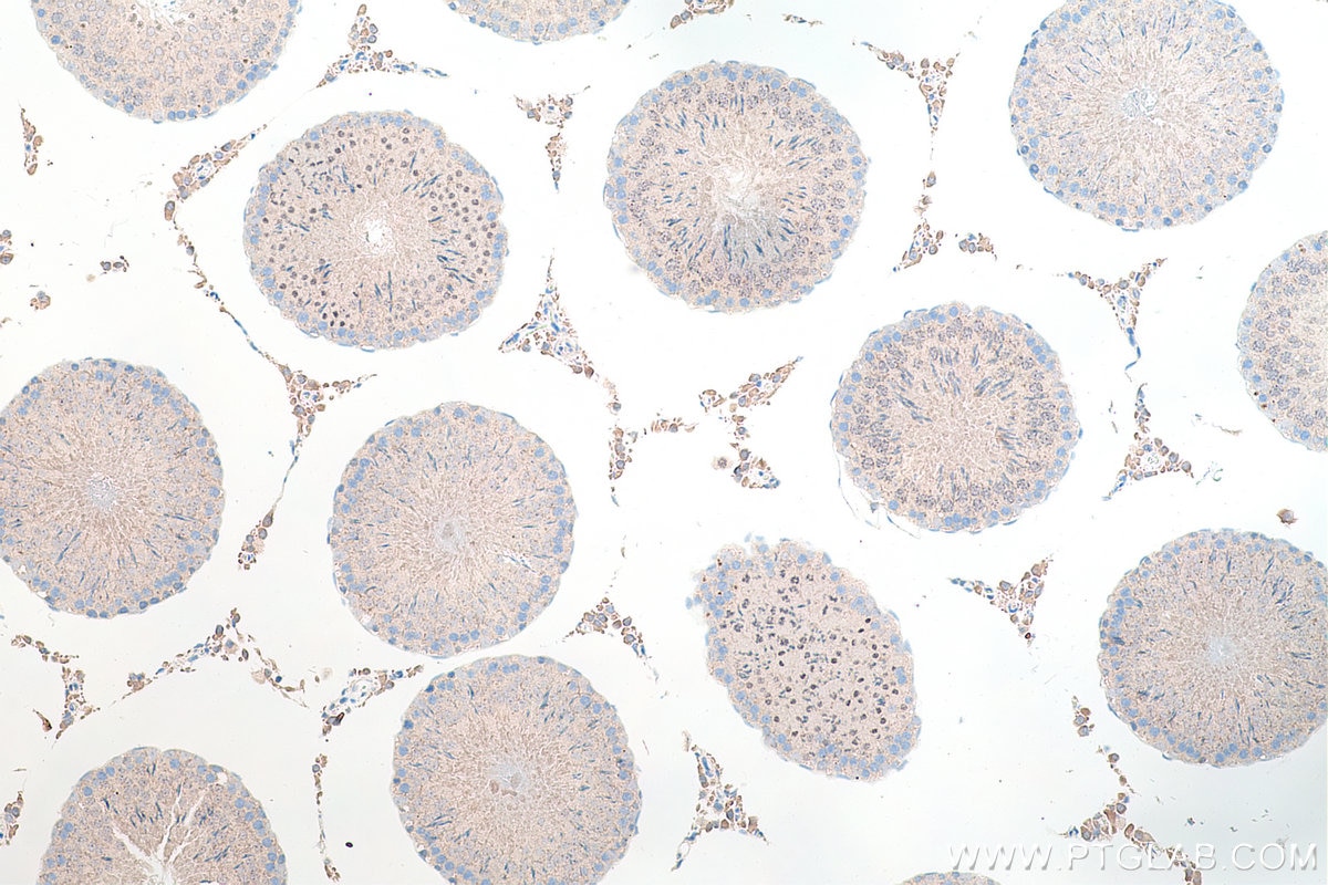 Immunohistochemical analysis of paraffin-embedded rat testis tissue slide using KHC0186 (DKC1 IHC Kit).