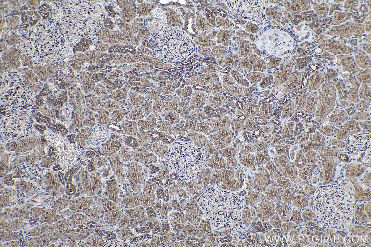 Immunohistochemical analysis of paraffin-embedded human kidney tissue slide using KHC1083 (DLEC1 IHC Kit).