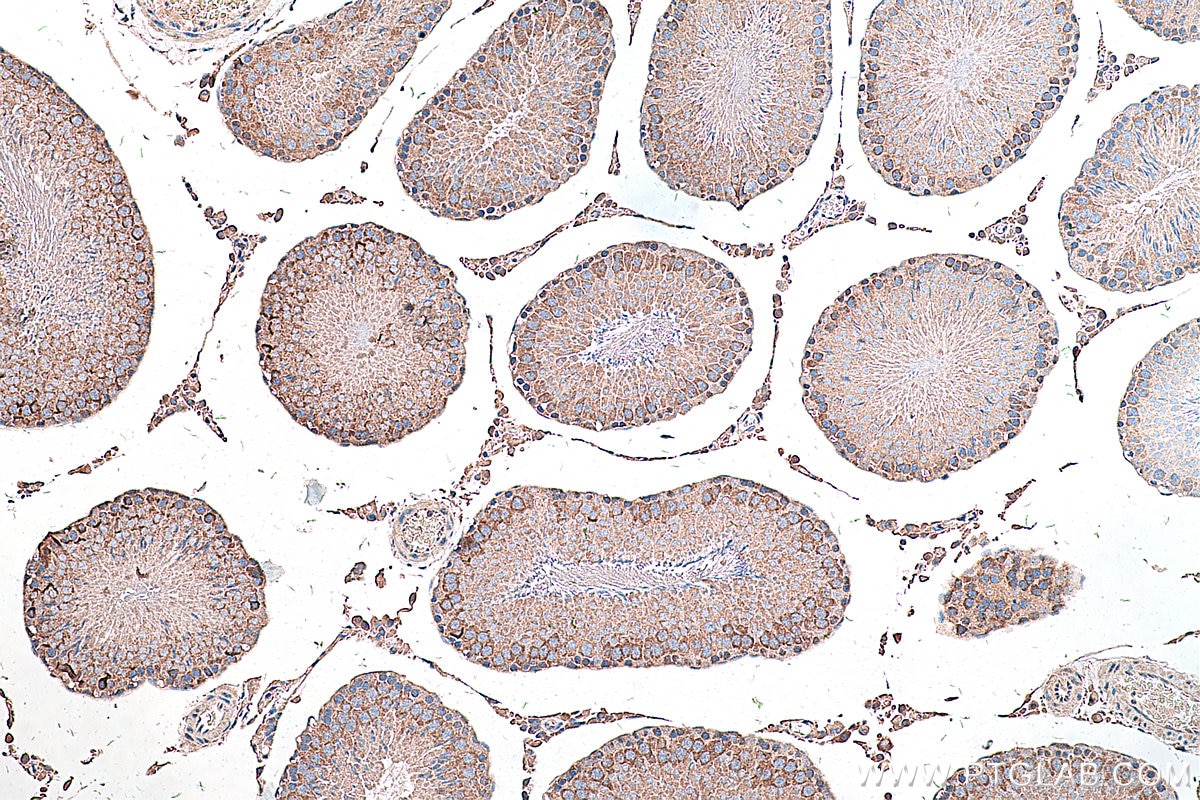 Immunohistochemical analysis of paraffin-embedded rat testis tissue slide using KHC0306 (DLK1 IHC Kit).