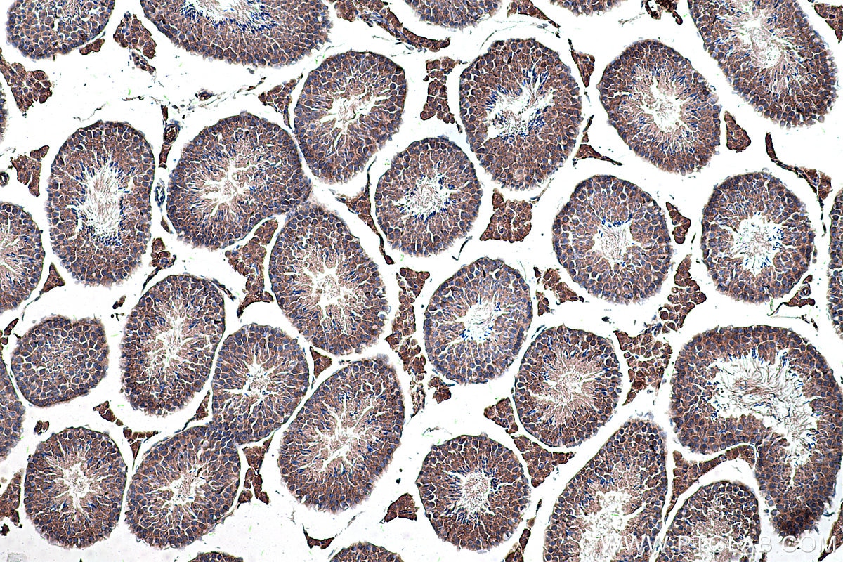 Immunohistochemical analysis of paraffin-embedded mouse testis tissue slide using KHC0306 (DLK1 IHC Kit).