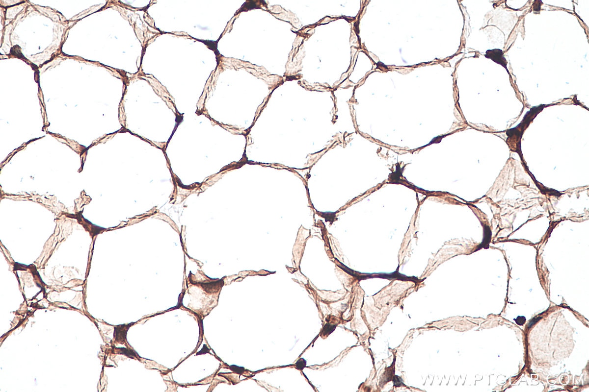 Immunohistochemical analysis of paraffin-embedded mouse testis tissue slide using KHC0306 (DLK1 IHC Kit).