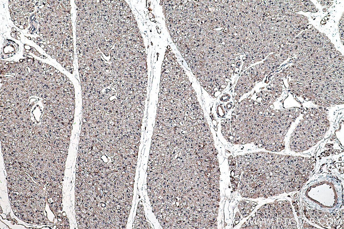 Immunohistochemical analysis of paraffin-embedded mouse brown adipose tissue slide using KHC0306 (DLK1 IHC Kit).