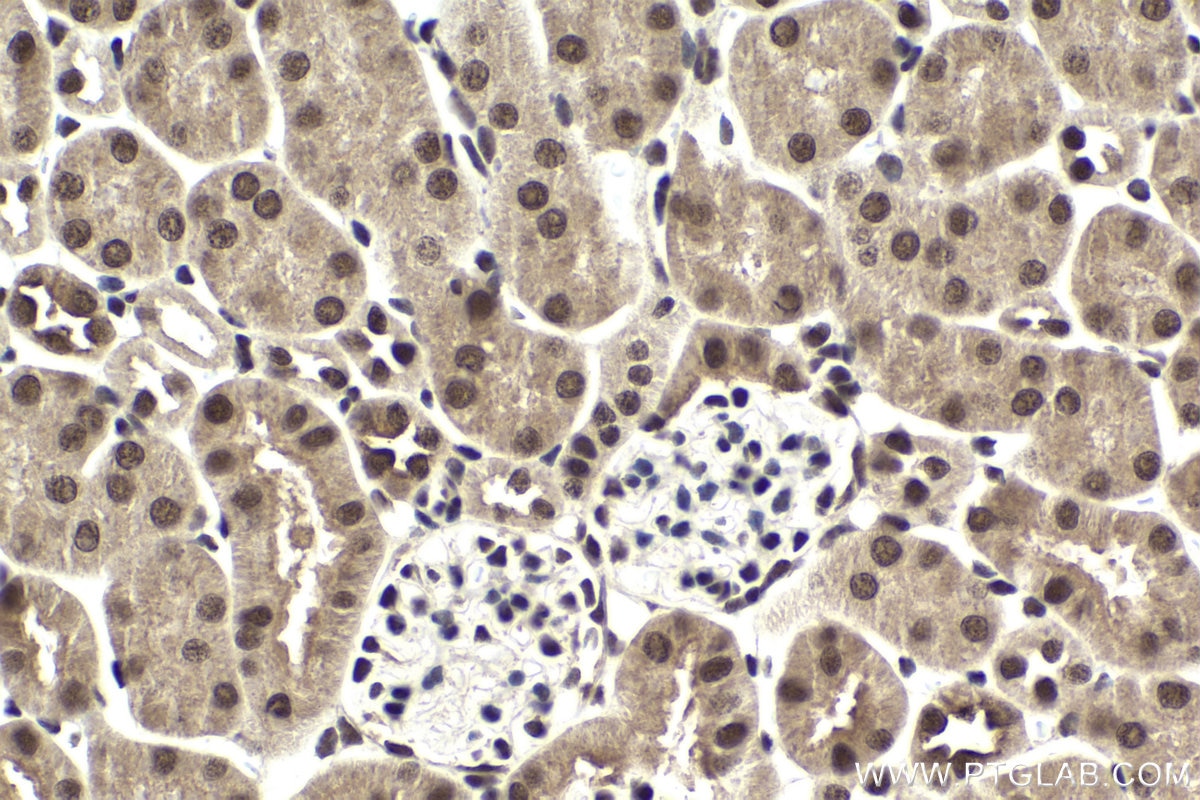 Immunohistochemical analysis of paraffin-embedded mouse kidney tissue slide using KHC1953 (DMAP1 IHC Kit).