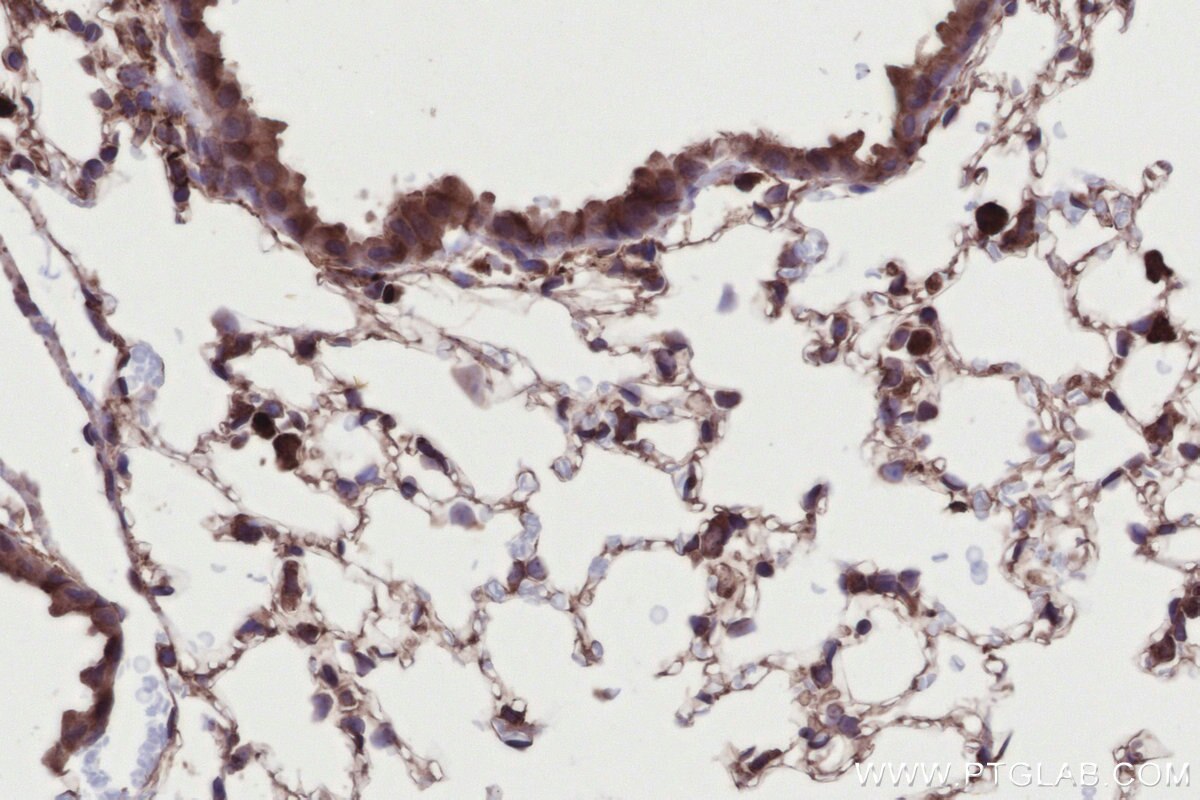 Immunohistochemical analysis of paraffin-embedded mouse lung tissue slide using KHC2718 (DMXL2 IHC Kit).