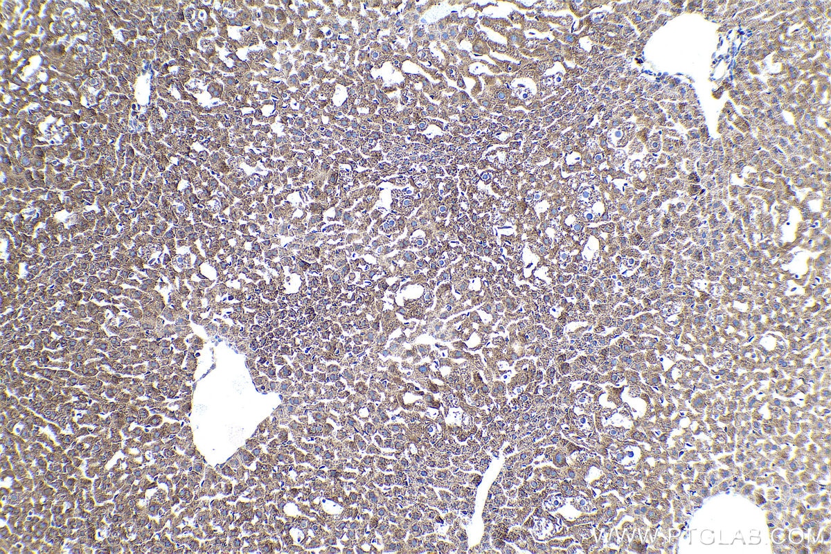 Immunohistochemical analysis of paraffin-embedded mouse liver tissue slide using KHC0936 (DNAJB11 IHC Kit).