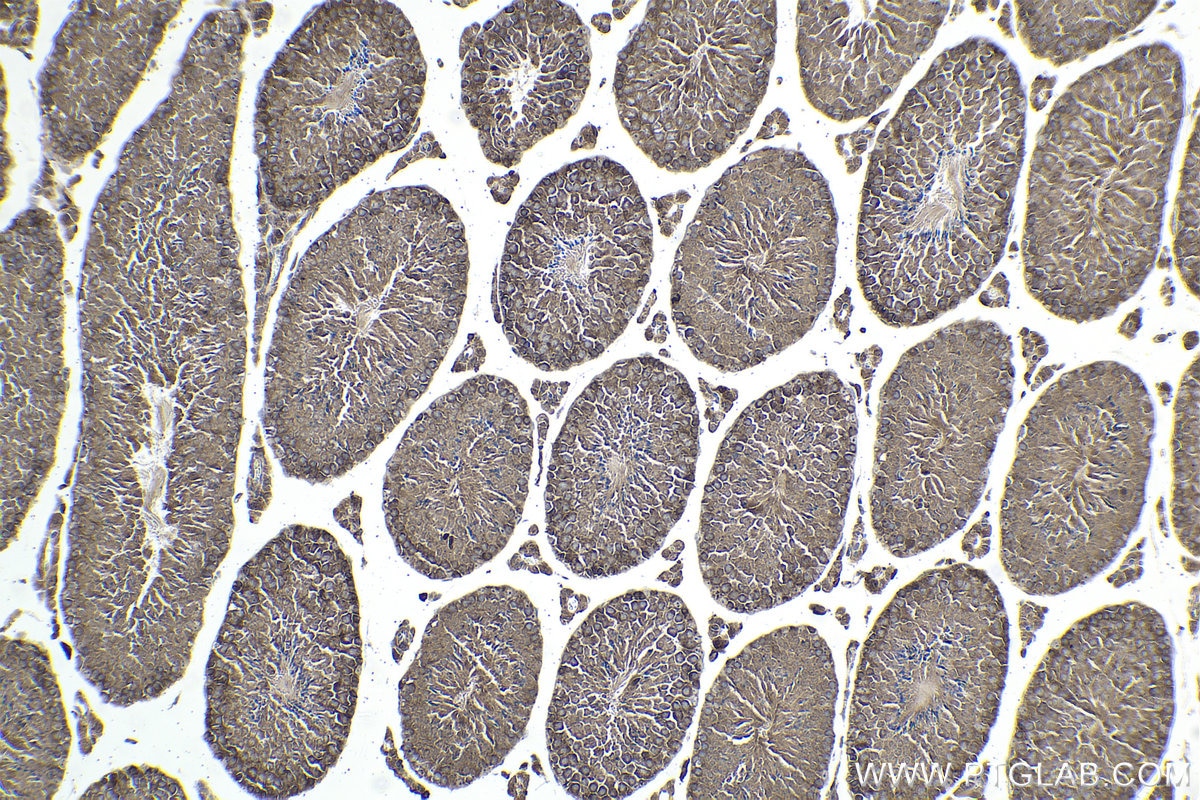 Immunohistochemical analysis of paraffin-embedded mouse testis tissue slide using KHC1890 (DNAJC2/ZRF1 IHC Kit).